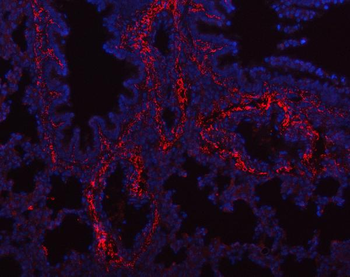 Collagen I/COL1A1 Rabbit Polyclonal Antibody