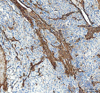 Collagen I/COL1A1 Rabbit Polyclonal Antibody