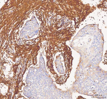 Collagen I/COL1A1 Rabbit Polyclonal Antibody