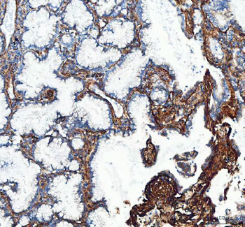 Collagen I/COL1A1 Rabbit Polyclonal Antibody