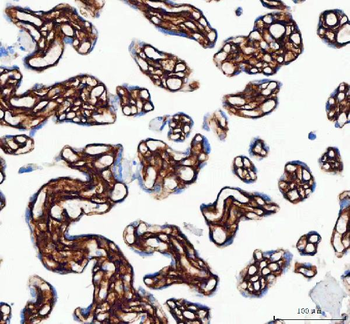 Collagen I/COL1A1 Rabbit Polyclonal Antibody