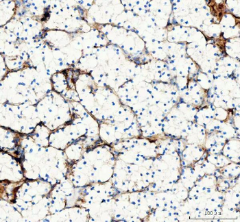 Collagen I/COL1A1 Rabbit Polyclonal Antibody