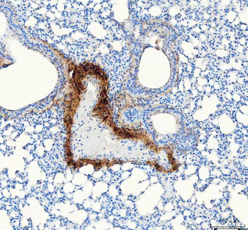 Collagen I/COL1A1 Rabbit Polyclonal Antibody