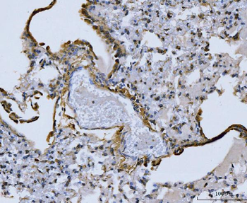 Collagen I/COL1A1 Rabbit Polyclonal Antibody