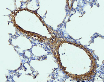 Collagen I/COL1A1 Rabbit Polyclonal Antibody