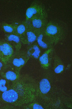 Intestinal FABP/FABP2 Rabbit Polyclonal Antibody
