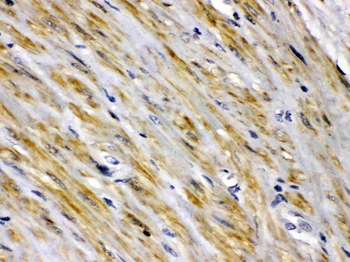 Intestinal FABP/FABP2 Rabbit Polyclonal Antibody