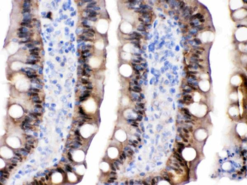 Intestinal FABP/FABP2 Rabbit Polyclonal Antibody