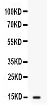 Intestinal FABP/FABP2 Rabbit Polyclonal Antibody