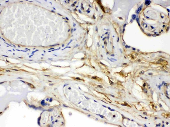 FGF1 Rabbit Polyclonal Antibody