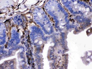 FGF1 Rabbit Polyclonal Antibody