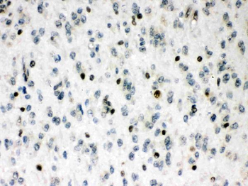MEF2A Rabbit Polyclonal Antibody