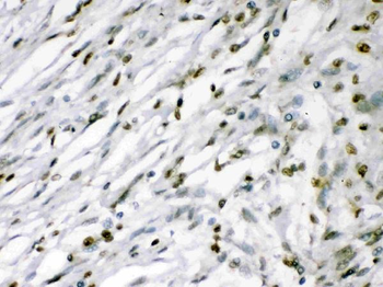MEF2A Rabbit Polyclonal Antibody