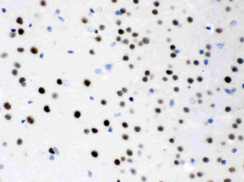 MEF2A Rabbit Polyclonal Antibody