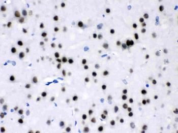 MEF2A Rabbit Polyclonal Antibody