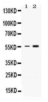 MEF2A Rabbit Polyclonal Antibody