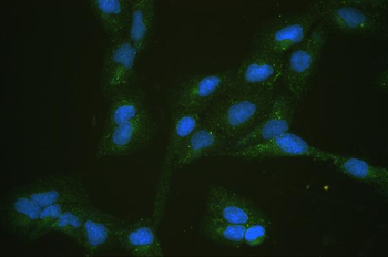 Glucose Transporter 5 GLUT5/SLC2A5 Rabbit Polyclonal Antibody