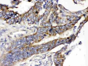 Glucose Transporter 5 GLUT5/SLC2A5 Rabbit Polyclonal Antibody