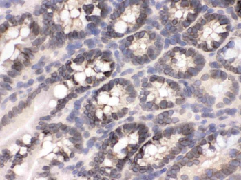 CRM1/XPO1 Rabbit Polyclonal Antibody