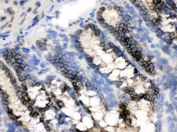 CRM1/XPO1 Rabbit Polyclonal Antibody