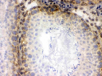 CRM1/XPO1 Rabbit Polyclonal Antibody