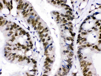 CRM1/XPO1 Rabbit Polyclonal Antibody
