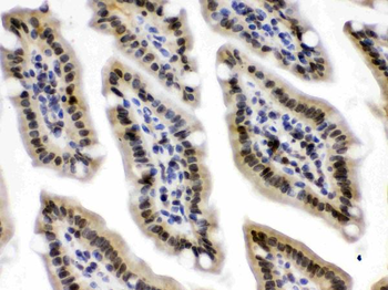 CRM1/XPO1 Rabbit Polyclonal Antibody