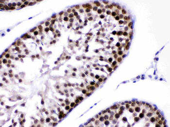 CRM1/XPO1 Rabbit Polyclonal Antibody