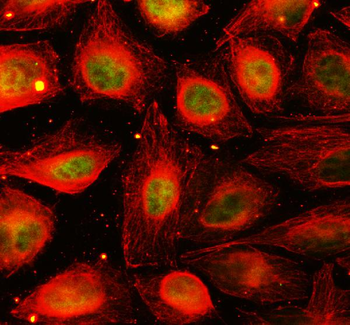 YAP1 Rabbit Polyclonal Antibody