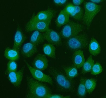 YAP1 Rabbit Polyclonal Antibody