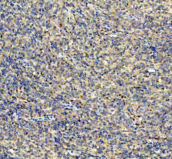 YAP1 Rabbit Polyclonal Antibody