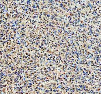 YAP1 Rabbit Polyclonal Antibody