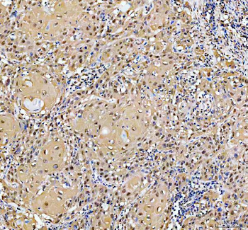 YAP1 Rabbit Polyclonal Antibody
