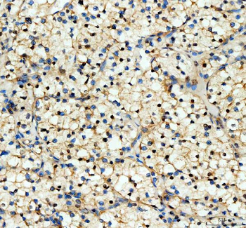 YAP1 Rabbit Polyclonal Antibody