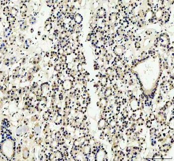 YAP1 Rabbit Polyclonal Antibody
