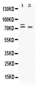 Plzf/ZBTB16 Rabbit Polyclonal Antibody