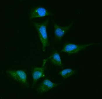 Alpha Actinin 4/ACTN4 Rabbit Polyclonal Antibody