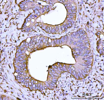 Alpha Actinin 4/ACTN4 Rabbit Polyclonal Antibody