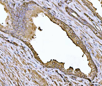 Alpha Actinin 4/ACTN4 Rabbit Polyclonal Antibody
