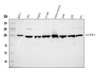 Alpha Actinin 4/ACTN4 Rabbit Polyclonal Antibody