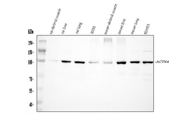 Alpha Actinin 4/ACTN4 Rabbit Polyclonal Antibody
