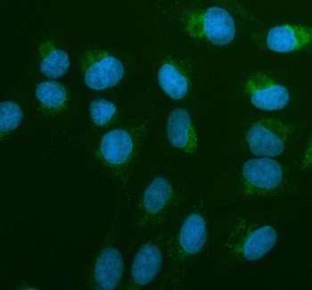 AIRE Rabbit Polyclonal Antibody