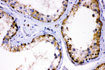 AMHR2 Rabbit Polyclonal Antibody