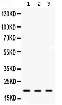 ARF6 Rabbit Polyclonal Antibody