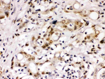 Cyclin T1/CCNT1 Rabbit Polyclonal Antibody