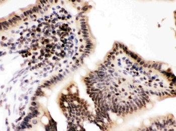 Cyclin T1/CCNT1 Rabbit Polyclonal Antibody
