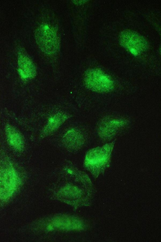 TCP1 beta/CCT2 Rabbit Polyclonal Antibody