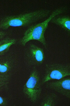 TCP1 beta/CCT2 Rabbit Polyclonal Antibody
