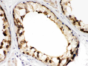 TCP1 beta/CCT2 Rabbit Polyclonal Antibody