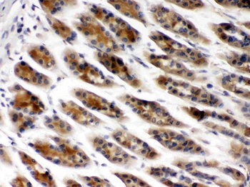 TCP1 beta/CCT2 Rabbit Polyclonal Antibody